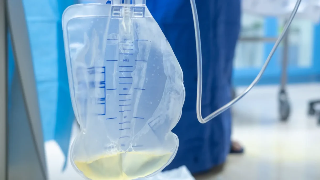 Co to jest cewnik urologiczny